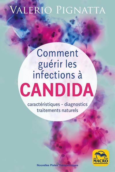 Comment guérir les infections à candida - Image principale