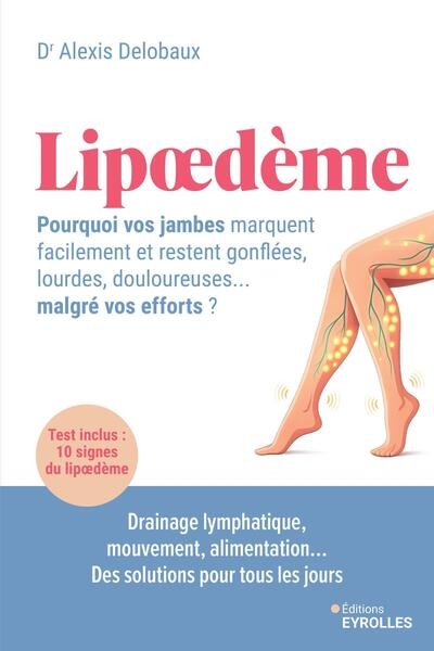 Lipoedème : pourquoi vos jambes marquent facilement et restent gonflées, lourdes, douloureuses... malgré vos efforts ? - Image principale