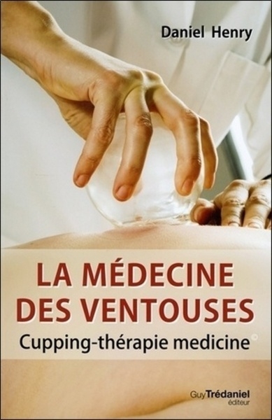 La médecine des ventouses - Image principale
