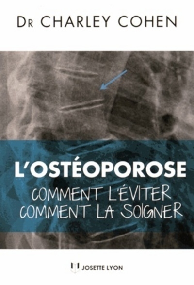 L'osteoporose - comment l'éviter, comment la soigner - Image principale